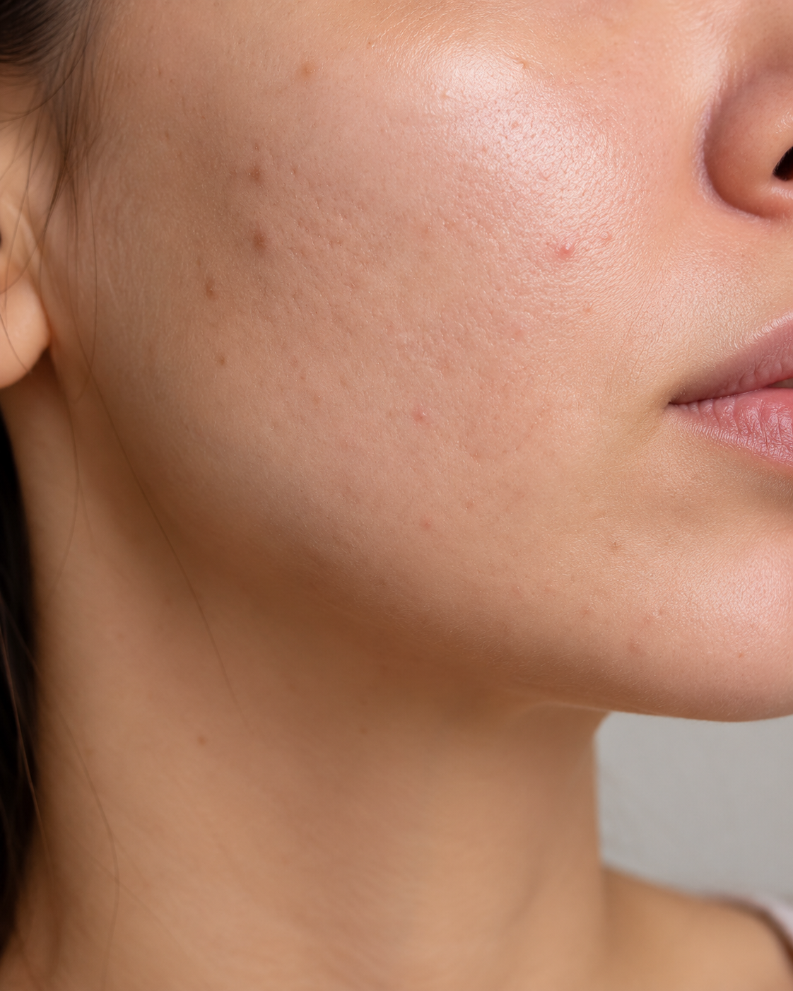 Close-up van huidtextuur met zichtbaar onrustigere huid voor consistente skincare routine